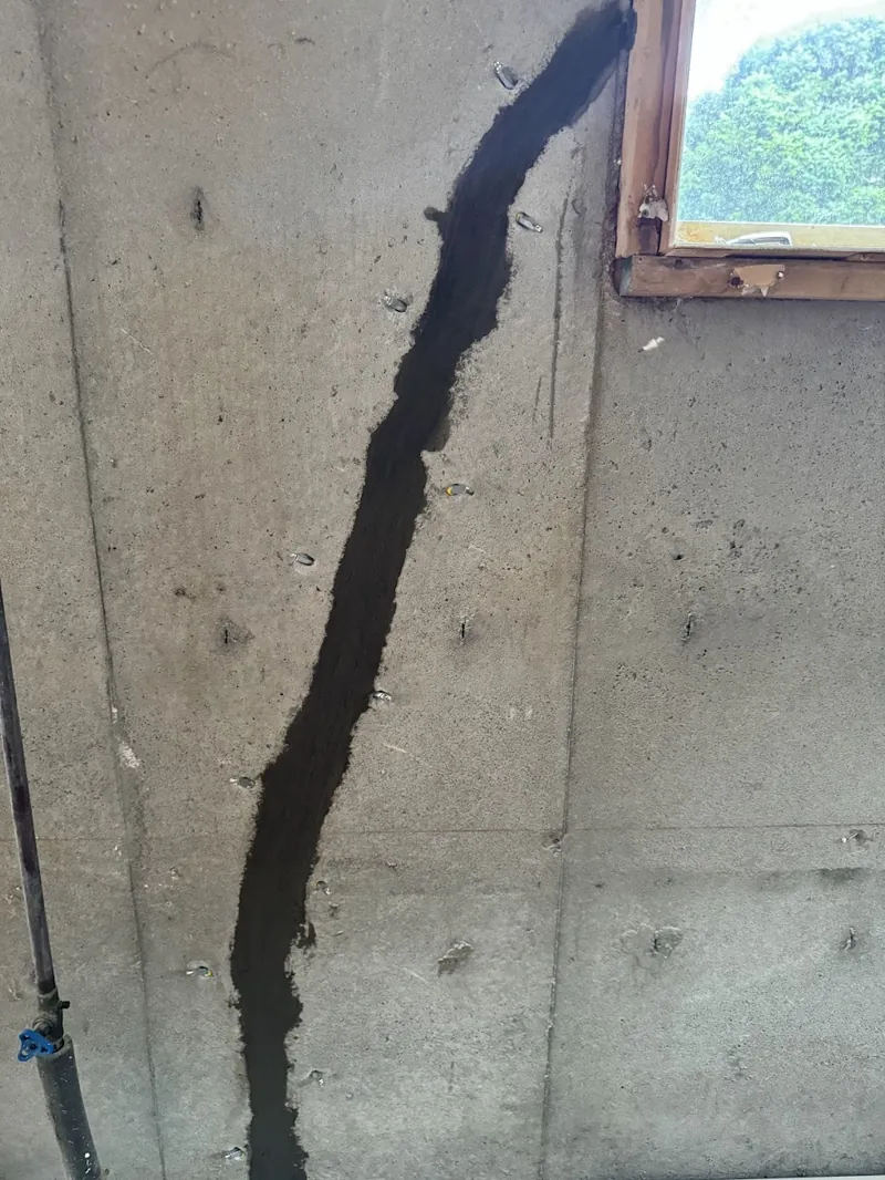 Fissure scellée avant l’injection